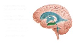 Hirnventrikel Instructional Video