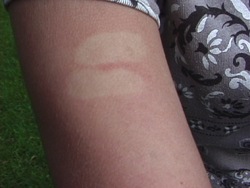 Sequridad climática: seguridad en clima templado Instructional Video