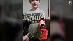 Beyond bionics: how the future of prosthetics is redefining humanity – video Instructional Video
