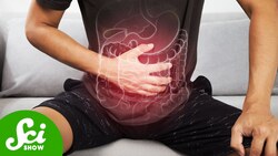 Why More Young People Are Getting Colon Cancer Instructional Video