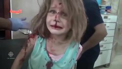 Wounded 8-year-old girl cries for father after bombing attack News Clip