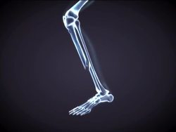 Healthy Skeletal and Muscular Systems: Problems of the Skeletal System Instructional Video