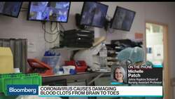 Coronavirus Can Cause Damaging Blood Clots From Brain to Toes News Clip