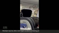 Boeing plane launches passengers from seats, injuring dozens News Clip