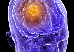 Science of Addiction Instructional Video