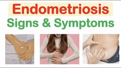 Endometriosis Signs & Symptoms (& Why They Occur) Instructional Video