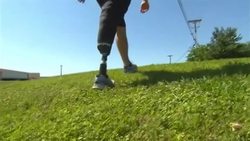 Transforming Lives With Prosthetics: The future of prosthetics Instructional Video