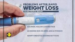 Ozempic side effect leaves weight loss drug users looking like 'melted candles' News Clip