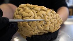 Inside the Brain of a Cadaver Instructional Video