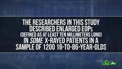 No Phones Arent Giving Kids Horns Seriously Instructional Video