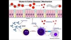 GLUTEN! Mechanisms of Celiac Disease and Gluten Sensitivity Instructional Video