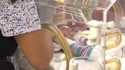 Capacity of Alberta's neonatal ICUs concerns some doctors News Clip