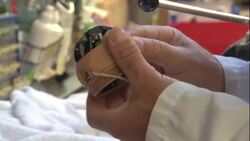 Scientists recreate sense of feeling for amputees News Clip