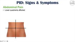Pelvic Inflammatory Disease (PID) Signs & Symptoms (& Why They Occur) Instructional Video