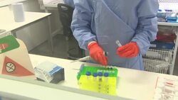 UK: Scientists at Liverpool School of Tropical Medicine testing samples of Covid-19 News Clip