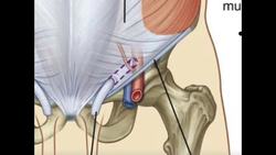 Anatomy - The Inguinal Ligament & Inguinal Canal Instructional Video