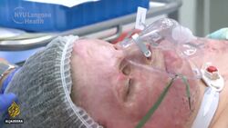 World's first full face and double hand transplant successful, doctors say News Clip