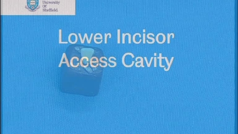 Thumbnail for Lower incisor access cavity