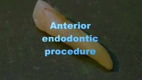 Thumbnail for entry Anterior endodontic procedure
