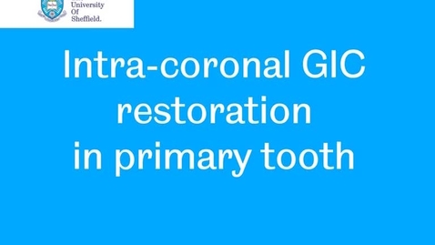 Thumbnail for entry GIC DO restoration of a primary tooth