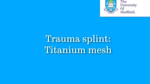 Thumbnail for entry Titanium mesh trauma splint