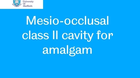Thumbnail for Class II amalgam cavity