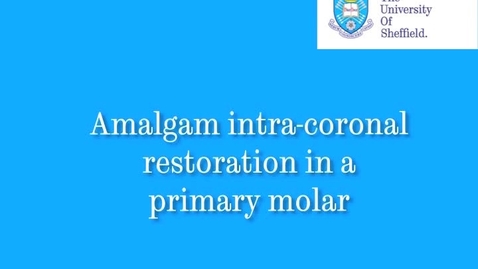 Thumbnail for entry Intracoronal restoration on a primary tooth