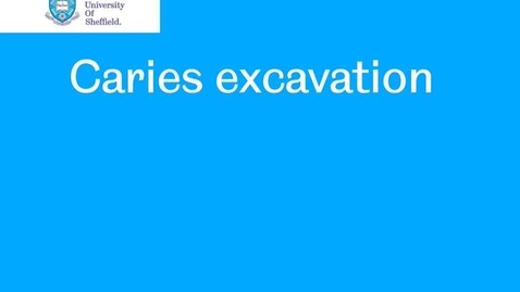 Thumbnail for Excavate caries
