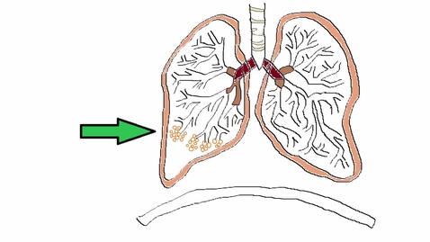 Thumbnail for entry Lungs and Gas Exchange - A Revision Guide