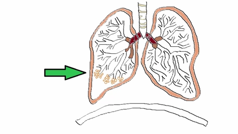 Thumbnail for Lungs and Gas Exchange - A Revision Guide