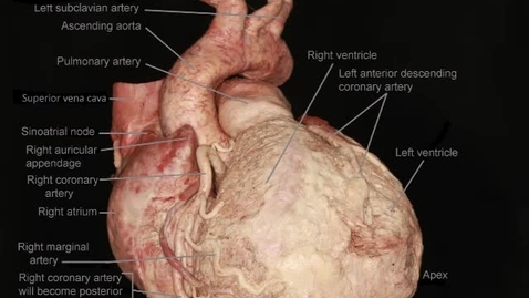 Thumbnail for Heart: horizontal rotation