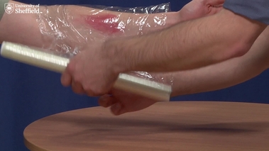 Go to Street Medicine Briefing: Burn Dressing with duration: 40 seconds