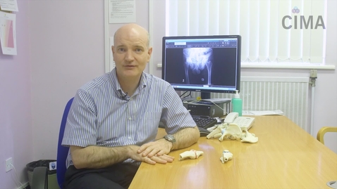 Thumbnail for Ageing Joints and Osteoarthritis
