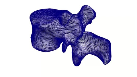 Thumbnail for ESR5-vertebra5