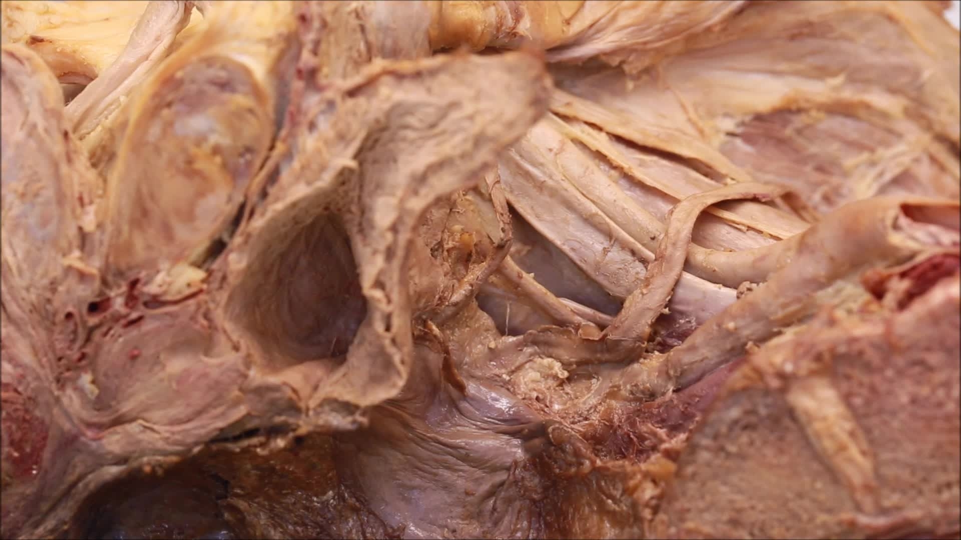 26 G Ureter And Vas Deferens The University Of Sheffield Kaltura Digital Media Hub