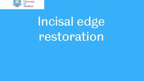 Thumbnail for entry Class IV Incisal Edge Restoration video