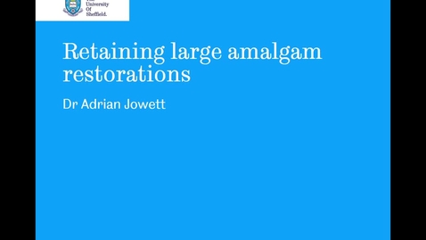 Thumbnail for Retaining large amalgam restorations - Quiz