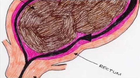 Thumbnail for The Gastro-Intestinal Tract