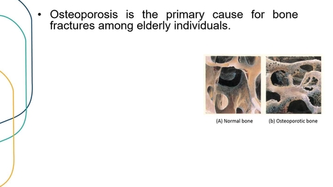 Thumbnail for entry Application 1 workflow: Prediction of osteoporotic fractures 