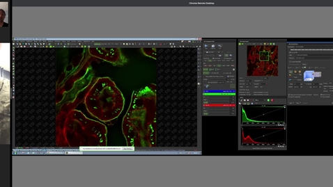 Thumbnail for entry Remote confocal microscopy demonstration