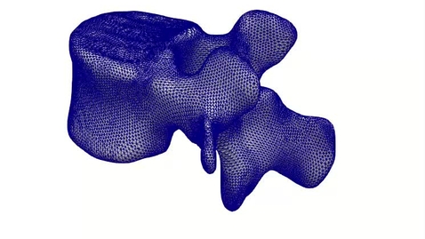 Thumbnail for ESR5-vertebra4