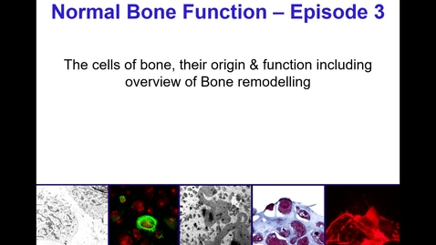 Thumbnail for entry Normal Bone Function - Episode 3
