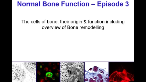 Thumbnail for Normal Bone Function - Episode 3
