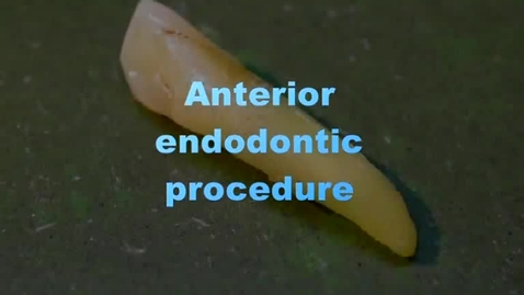 Thumbnail for Complete RCT procedure