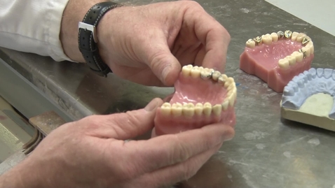 Thumbnail for See How They're Made: Dental Crowns