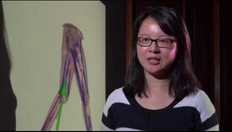 Go to Musculoskeletal disease: osteoporosis, modelling, muscles & bone strength with duration: 5 minutes, 7 seconds