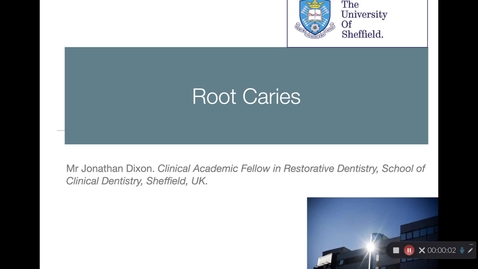 Thumbnail for entry Root Caries Lecture