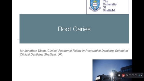Thumbnail for Root Caries Lecture