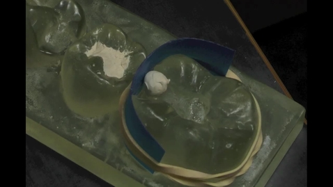 Thumbnail for Proximal composite restoration in plasticine