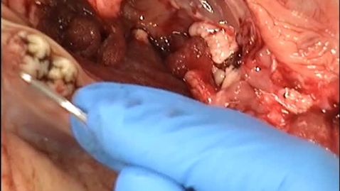 Thumbnail for Pigs Head Perio Flap Demo 2021